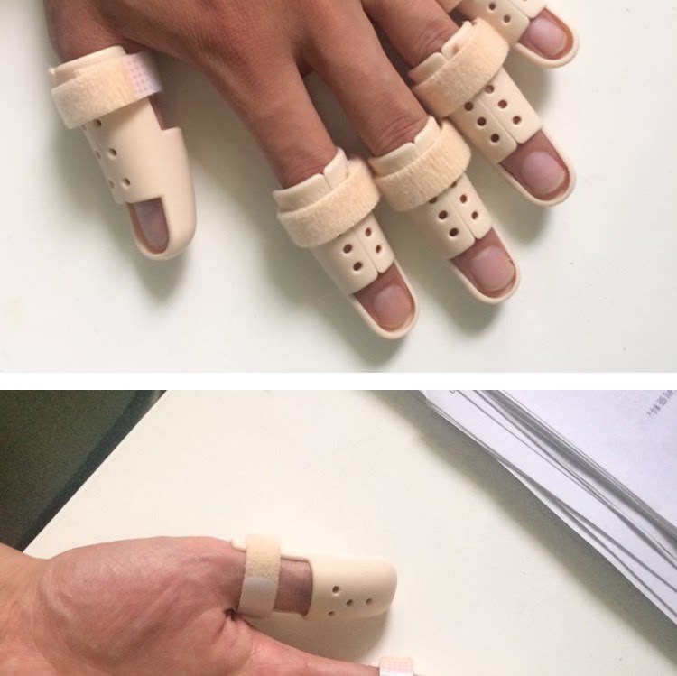 yi用锤状指 指套 手指骨折固定护 肌腱断裂曲形硬护托固定器