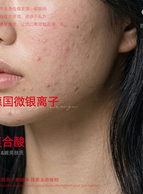 Cech瑟伊科微银乳液控油嫩肤强韧