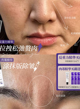 上提+熨纹！意大利麦可莉mycli反重力精华/肉度抗皱紧致精华