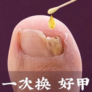 同仁堂热卖---不包不修 坏甲变好甲 祛除99%灰钾真菌 活动中