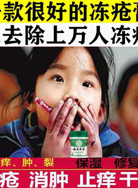 貂油冻疮膏止痒消肿冻伤膏手足耳朵脸冻伤药儿童护手霜开裂防冻膏