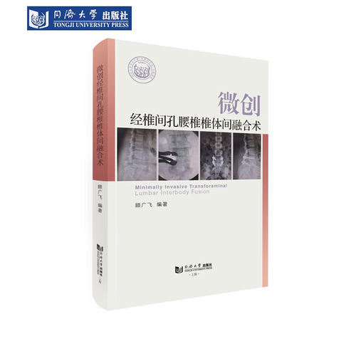 微创经椎间孔腰椎椎体间融合术 同济大学出版社