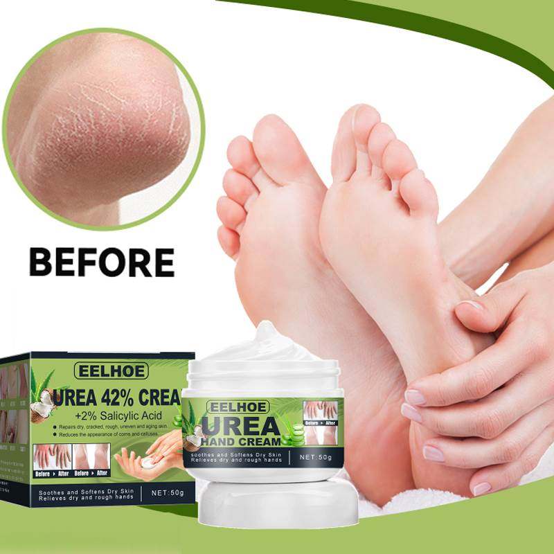 Urea cream hand foot care anti-dry Cracked exfoliation Remov