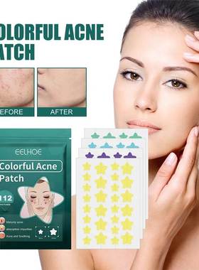 112pcs Pimple Patches Fade Face Spot Repair Star Shaped Pimp
