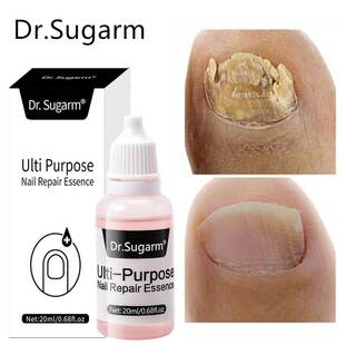 20ml Oil Repair Treatment Care Fungal Nail Dr.Sugarm Feet