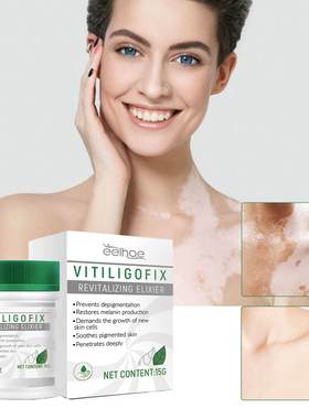 White Spot Repair Cream Skin Speckle White Spot 皮肤花斑白斑