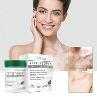 White Spot Repair Cream Skin Speckle White Spot 皮肤花斑白斑