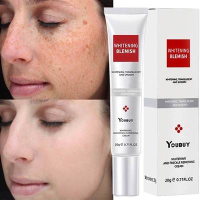 Whitening Freckle Cream Effective Remove Melasma Cream Remov