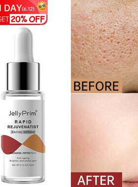 Pore Shrinking Dark Spots Face Serum Whitening For Glowing N