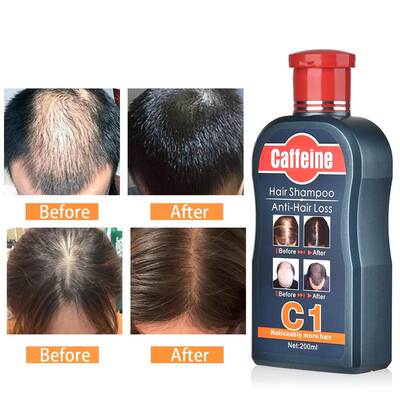 Caffeine Shampoo Slow Down Hair Loss Stimulate Hair Growth