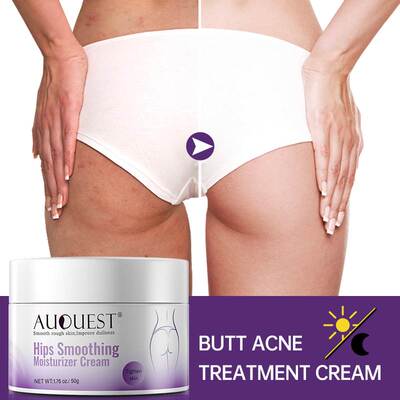Butt Body Acne Whitening Cream Emulsions Acne Clearing Spot