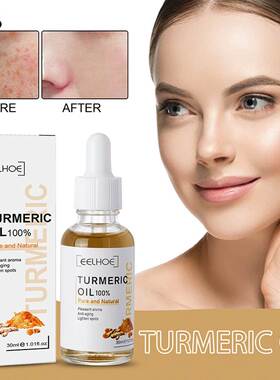 30ml Turmeric Oil Skin To Lightening Acne Dark Patches Acne