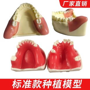 牙科材料种植练习模型上颌窦口腔模具培训班教学专用模型牙齿牙模