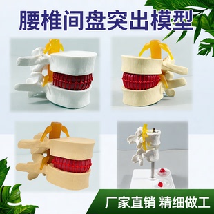 椎间盘模型正品医学人体腰椎突出脊柱脊椎骨病理演示关节标准模型