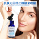 Acid skin Peel Shrink Glycolic Brighten 70% Pores 乙醇酸原液
