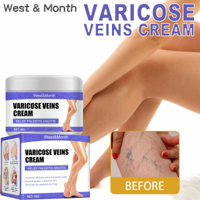 IntravenousRepaiCmLeg