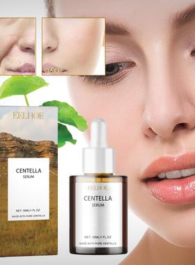 Centella asiatica essence improves face smoothes brightens