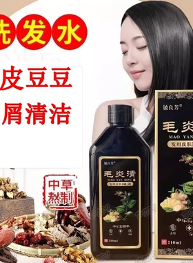 毛炎清去屑止控油洗发水正品毛 囊清洁豆豆专用屑姜王康王洗发水