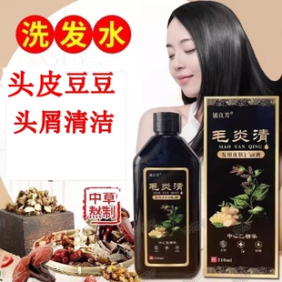 毛炎清去屑止控油洗发水正品毛 囊清洁豆豆专用屑姜王康王洗发水