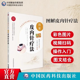 图解皮内针疗法中医针灸学埋针疗法技术操作规范辨证取穴对症选穴内针疗法诊治各科常见疾病零基础学中医实用技术适宜技术操作入门