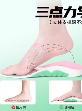鲸鱼垫专业足弓支撑鞋垫专治扁平足矫正足外翻内八字改善足部问题