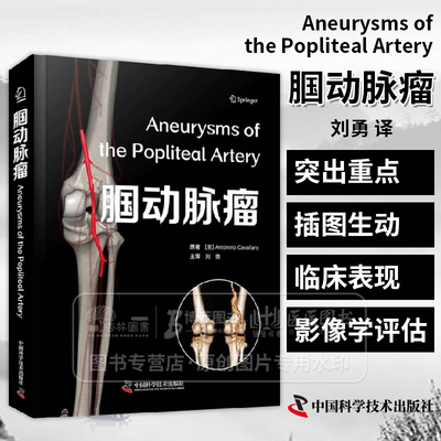 腘动脉瘤  意  安东尼诺·卡瓦拉罗 (Antonino Cavallaro) 著 中国科学技术出版社 9787523610671