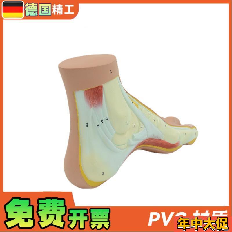 德国】PNT-0727 弓形足 模型 足部病理模型人体足部解剖模型脚关