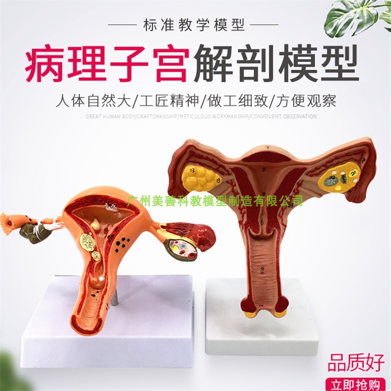 人体模型女性生殖子宫模型阴道卵巢模H型教学模具病理变化科学教
