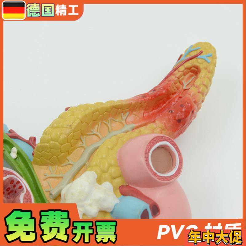 德国】教学仿真 病变胰脾肝胆十二指肠模型 病理胰腺标本 胰脾肝