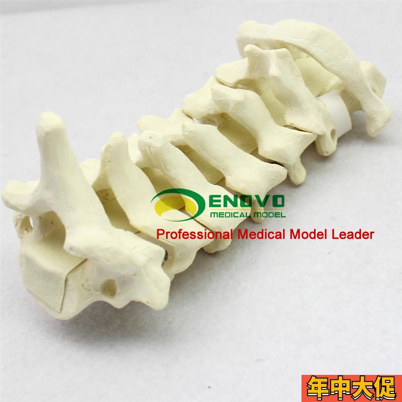 ENOVO颐诺骨科仿真人体颈椎模型 医学骨科手术仿真骨 颈椎前路后