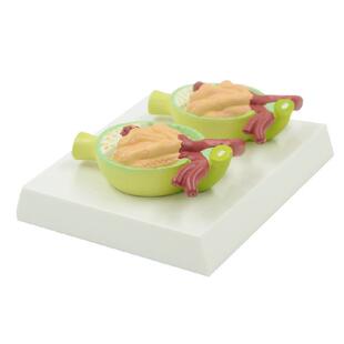 尿蛋白模型病理肾脏肾小球肾单位肾上腺病肾泌尿器官内分泌医患用