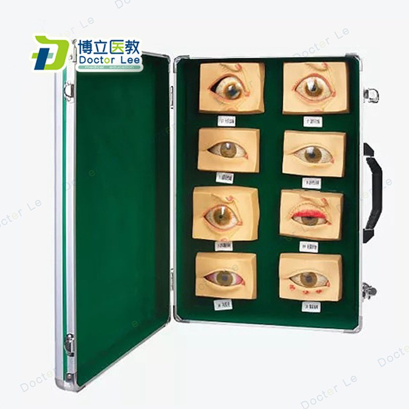 常见眼病模型h20只/套 眼睛疾病模型 眼模型 眼睛病态模型