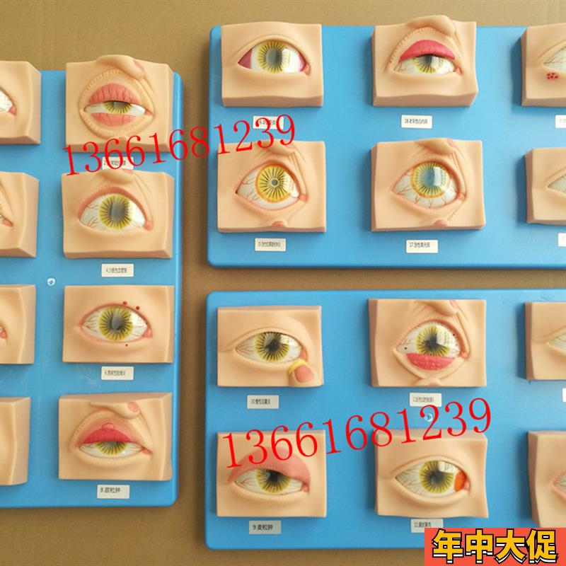 人体常见眼病模型常用眼科疾病模具教学指导病态眼睛示教标本20只