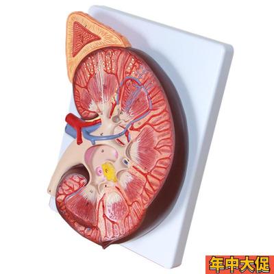 肾脏放大模型肾上腺仿真人体肾模具医用教学生物课配套中学生器材
