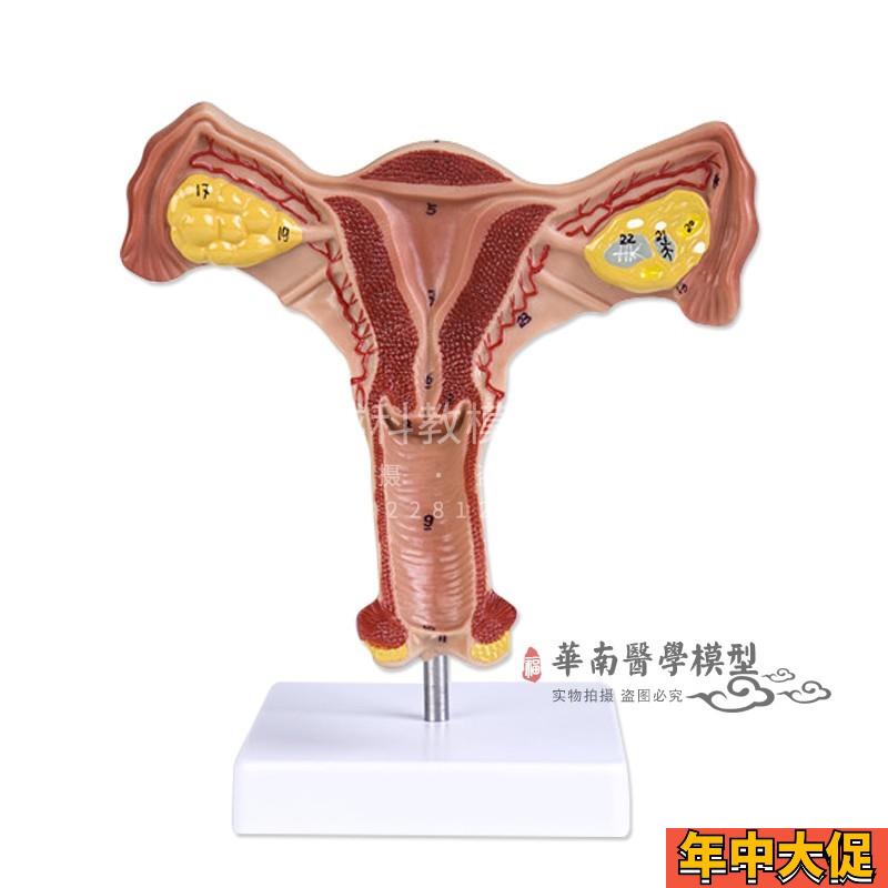 人体子宫解剖模型 女性生殖系统计生教育演示器材 厂家直销