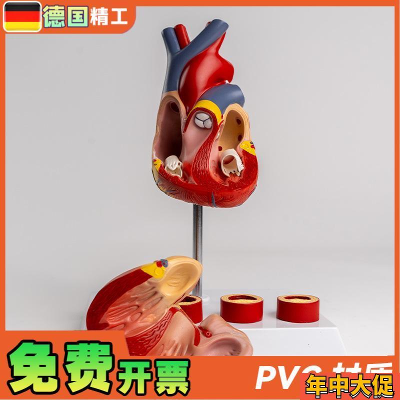 德国】心脏带血栓模型  解剖可拆卸教学仿真 自然大心脏带血栓血