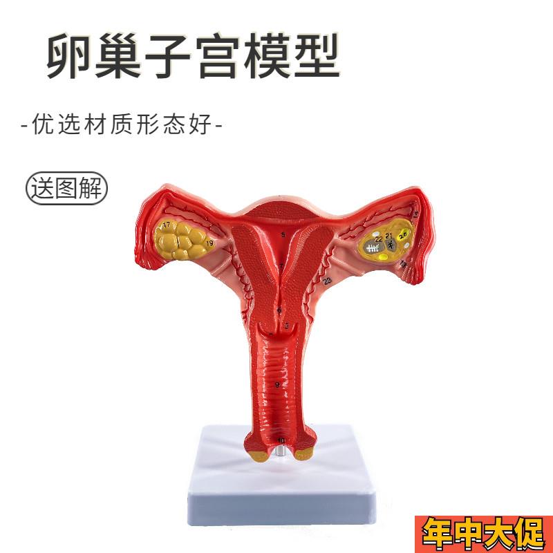 人体子宫解剖模型女性阴道生殖系统双侧卵巢子宫正常病理子宫教学