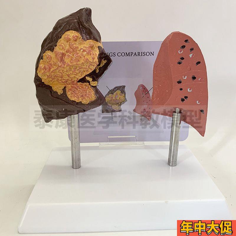 爱国卫生运动教育模型禁烟警示展示吸烟有害健康模型危害人体器官