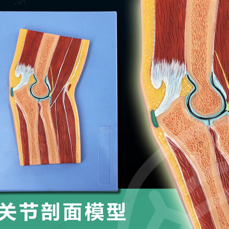 CT 肘关节切面 浮n雕 肘关节断层解剖学模型 手运动解剖学模型