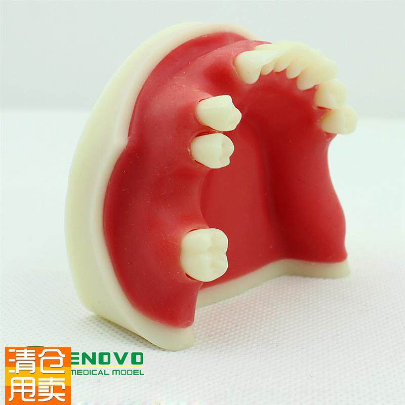 ENOVO颐诺口腔种植仿真下颌骨缺失牙模L型种植体牙医齿科牙齿模型