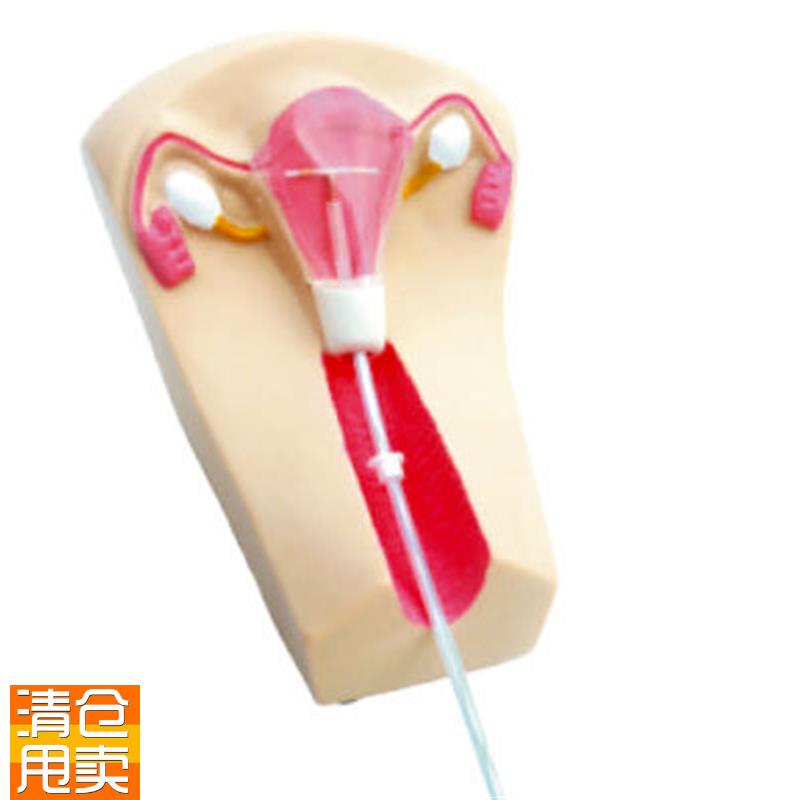 女性宫内避孕G器及训练模型