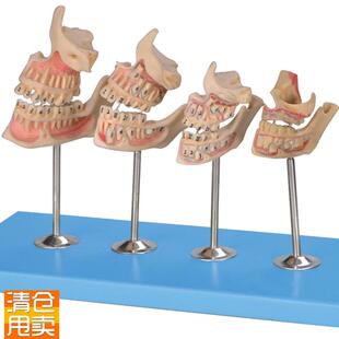 牙与颌骨的发育模型RB10006