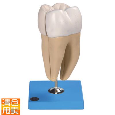 磨牙有两个牙根模型B10Y004/4