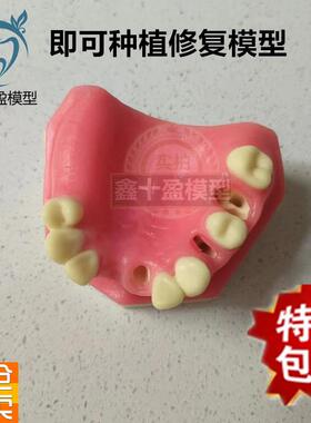 口腔种植练习模型上颌骨上颌窦牙列缺失种植体齿科牙S齿模型PIM21