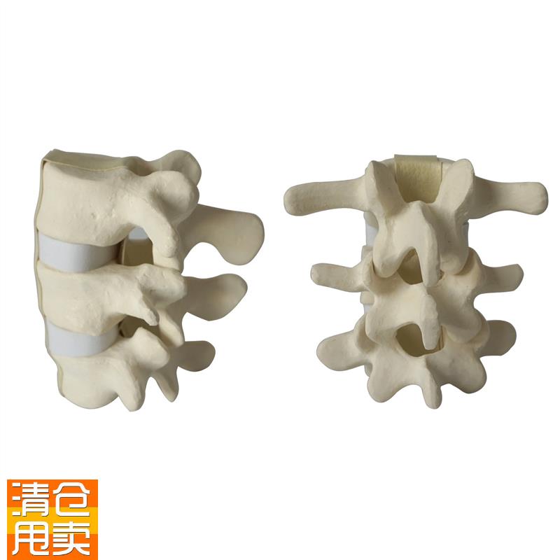 腰椎手术演示模型骨科仿真练习用骨骨科SawbXone骨教学