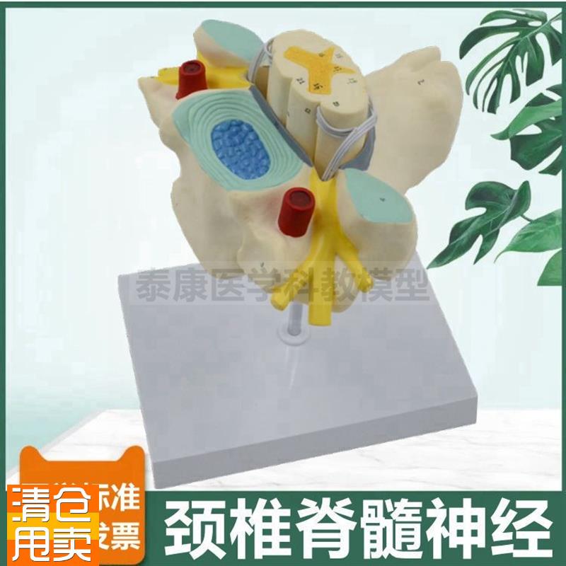颈椎脊髓模型脊神k经根交感神经椎管蛛网膜硬脊膜临床麻醉医生教