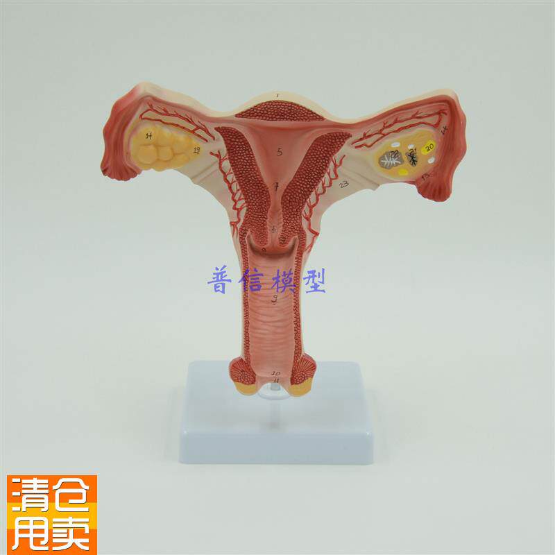 子宫模型生殖器解剖模型计划生育示I教模型教用医用解剖模型