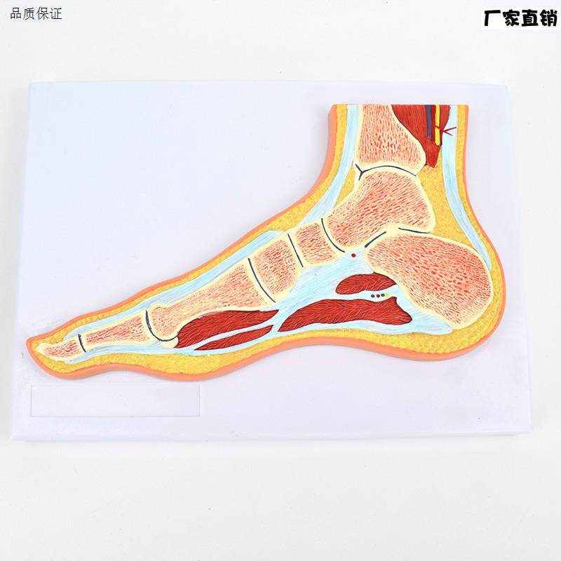 ENOVO颐诺医学足关节骨骼肌肉模型踝关节脚关U节构造MRI骨科教学
