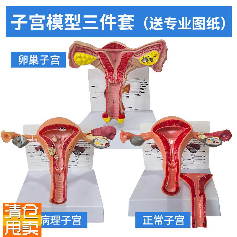 病理子宫模型病变子宫解剖卵巢模型妇G科教具医学人体女性生殖器
