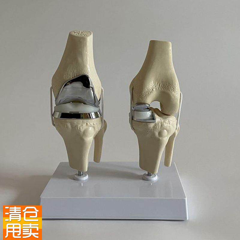 人工膝关节模型假肢软骨置换胫骨B平台垫片半月板骨科手术教学促